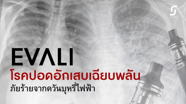 EVALI โรคปอดอักเสบเฉียบพลัน ภัยร้ายจากควันบุหรี่ไฟฟ้า